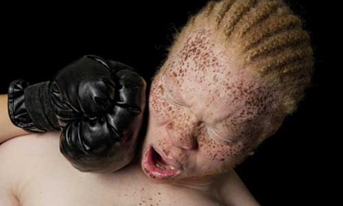 Illustration article Halte aux meurtres : un concours de beauté pour albinos !