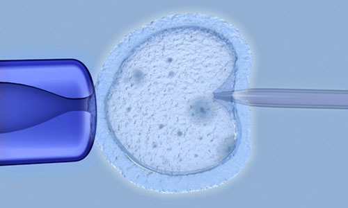 Illustration article Diagnostiquer ou pas la trisomie 21 sur un embryon?