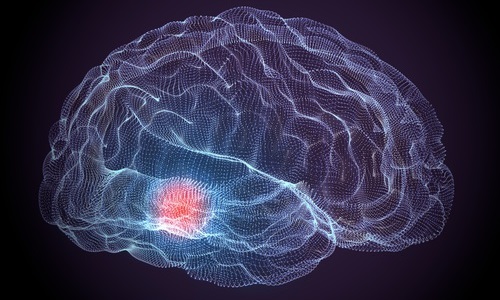 Illustration article 