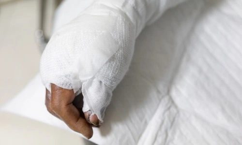 un patient br&ucirc;l&eacute; &agrave; l&rsquo;h&ocirc;pital