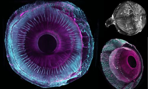 Deux clichés d’yeux transparisés avec différentes couleurs : rose, vert et viole