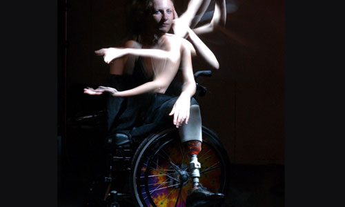 Illustration article Inédit : triple amputée, elle va obtenir un bras bionique