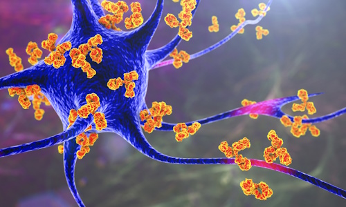 Illustration repr&eacute;sentant un neurone