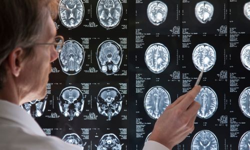 Un médecin qui analyse les résultats d’une IRM du cerveau.