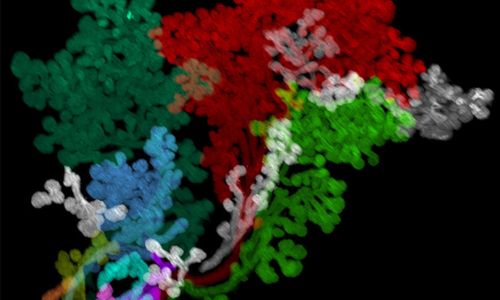 Malformations faciales : et si on cartographiait la tête?