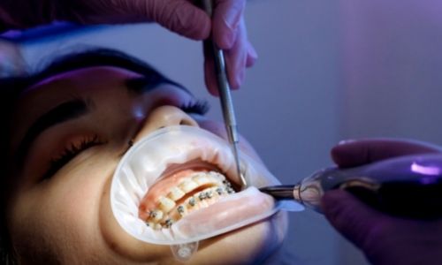 Illustration article Orthodontie  : trouver le bon praticien en cas de handicap