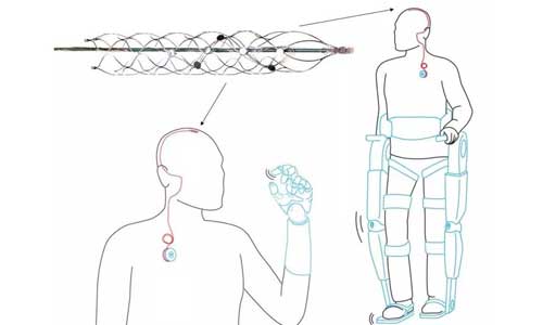 Illustration article Paraplégie : un implant pour marcher grâce à la pensée ?