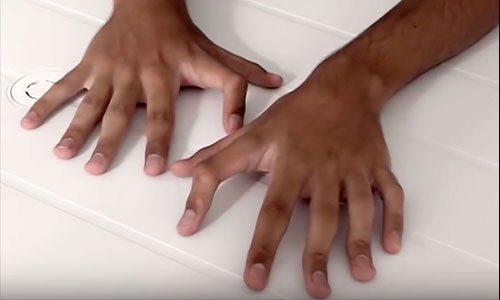 Polydactylie : 6 doigts dotés de capacités hors-normes