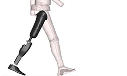 Illustration article Révolution dans les prothèses : des modèles "intelligents" ?