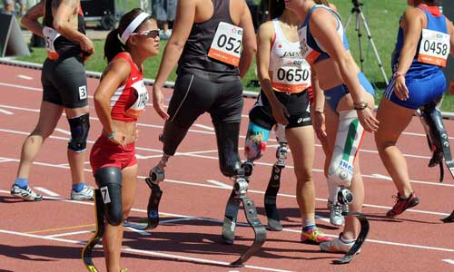 Illustration article Vers la gratuité des prothèses à usage sportif ?  