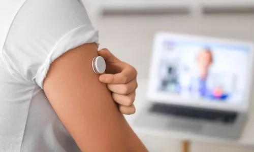 Jeune diab&eacute;tique &eacute;quip&eacute; d'un capteur de glucose en consultation m&eacute;dicale