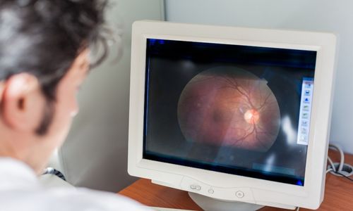 Illustration article SEP: un test pour évaluer l'étendue de la maladie via l'œil 