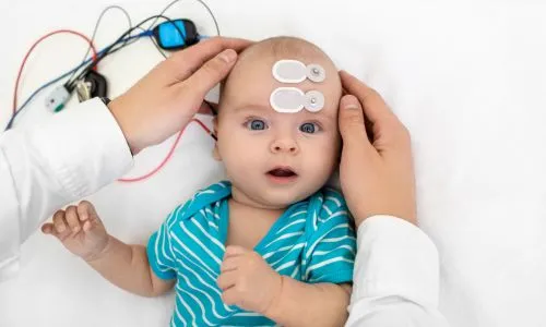 Bébé passe un test auditif (électrodes sur le front et écouteur dans l’oreille)