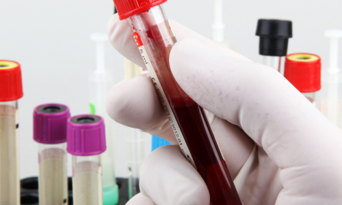 tubes d&rsquo;analyse sanguine