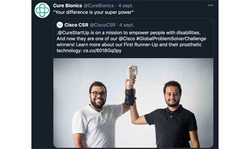 Tunisie : une main bionique modulable imprimée en 3D 