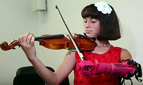 Illustration article A 10 ans, elle joue du violon avec une prothèse imprimée 3D