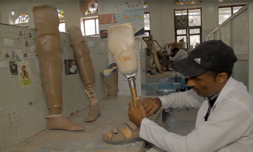 Illustration article Yémen: les personnes handicapées, 1ères victime de la guerre