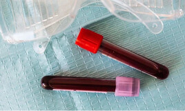 Inflammation : une piste cl&eacute; en psychiatrie